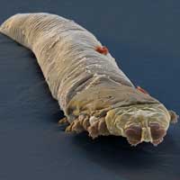 acaros_eliminar_fumigar_polvo_cama_200x200_demodex_canis acaros_eliminar_fumigar_polvo_cama_200x200_demodex_canis